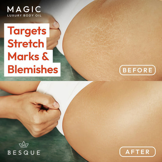 Besque Original Magic Body Oil - Hydrating Body Oils for Women - 200ml